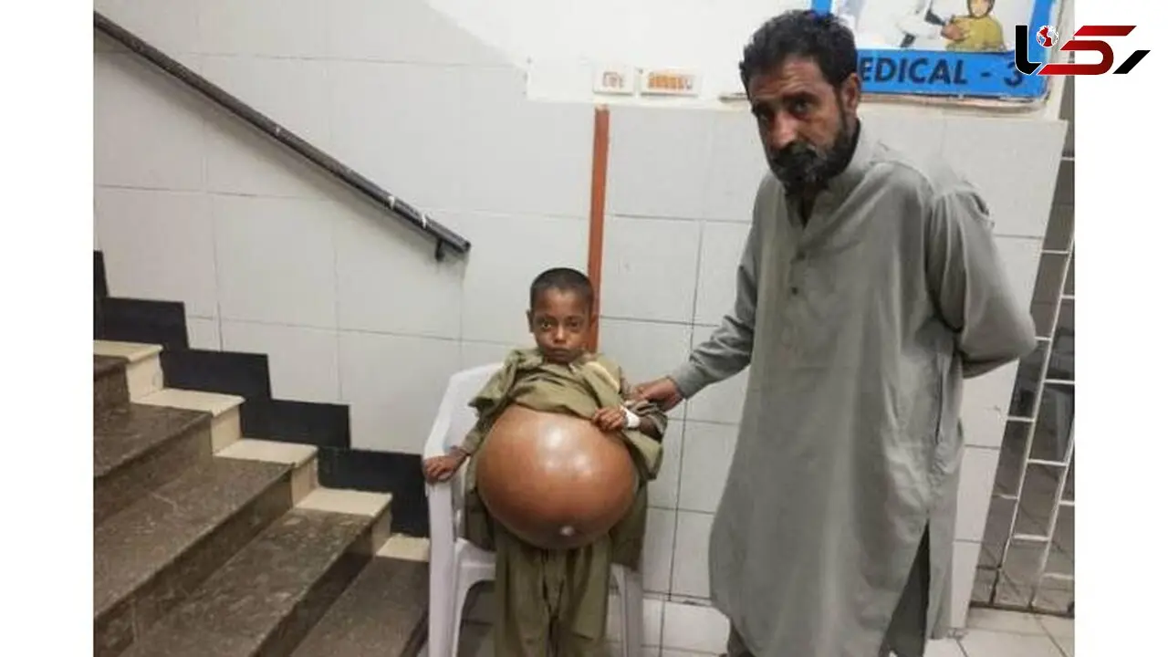 این پسر 9 ساله عجیب ترین درد را دارد! + عکس