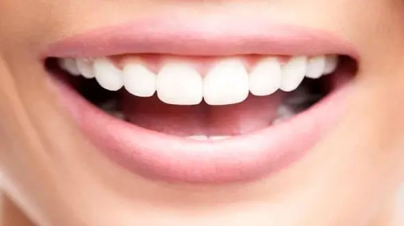 نسخه های خانگی برای سفید کردن دندان های