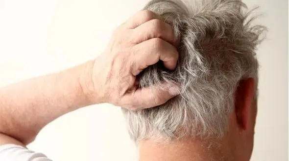 مبارزه با خارش های آزاردهنده پوست سر + طلایی ترین راهکارها