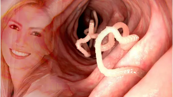 کرم های انگلی عجیب که از پیری جلوگیری می کنند