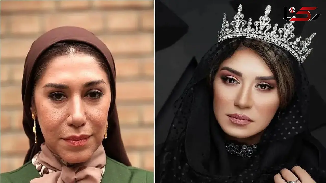 نگاهی به تغییرات بسیار زیاد چهره و سبک نسیم ادبی / عکس های مدلینگی عجیب با الهالم از رز سیاه و قرمز