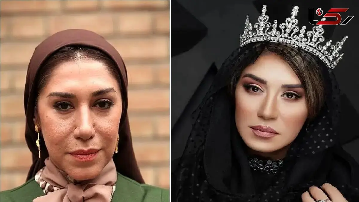 نگاهی به تغییرات بسیار زیاد چهره و سبک نسیم ادبی / عکس های مدلینگی عجیب با الهالم از رز سیاه و قرمز