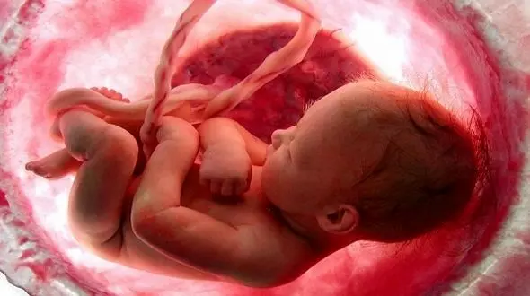 عجیب / نوزادی که هنگام تولد یک بچه در شکمش داشت / مصر