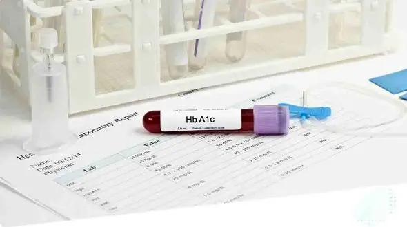 آزمایش قند خون A1C چیست و چطور تفسیر می شود؟