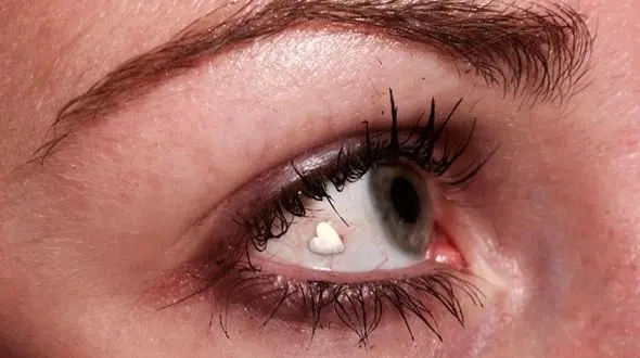 دردسر عمل های زیبایی عجیب برای دختر ایرانی !+ عکس