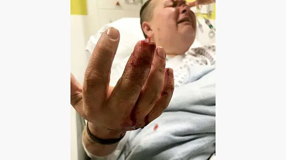 حادثه غیر منتظره، راننده پیک را روانه بیمارستان کرد! + تصاویر