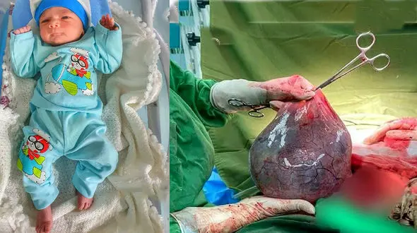 تولد نوزاد عجیب قمی همه را شوکه کرد

