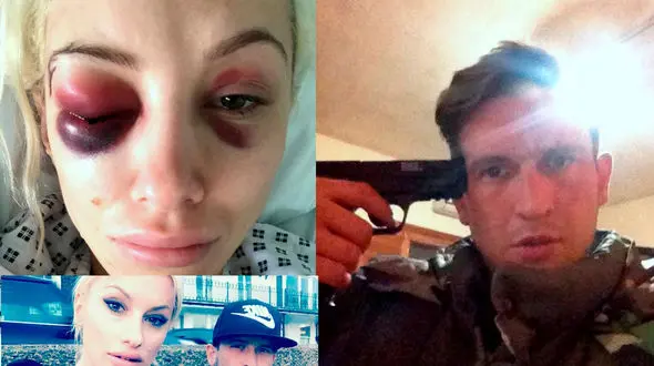 کور شدن خانم مدل توسط یک مرد در حمام +عکس 