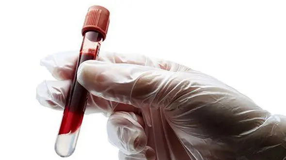 hemoglobin در آزمایش خون چیست؟ + دلایل انجام آزمایش هموگلوبین