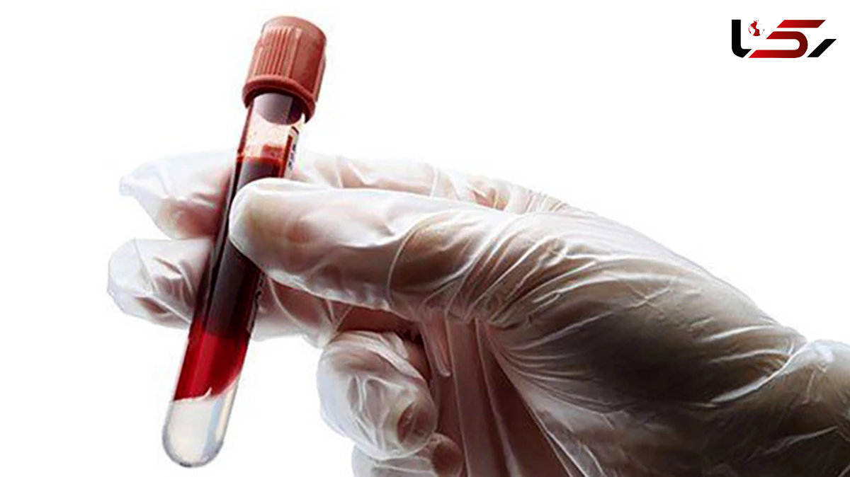 hemoglobin در آزمایش خون چیست؟ + دلایل انجام آزمایش هموگلوبین