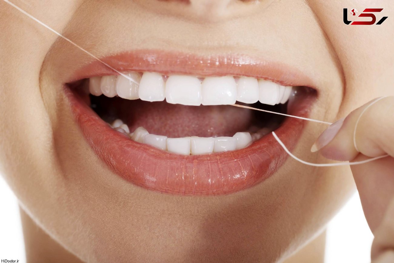 جلوگیری از تحلیل لثه با نخ دندان