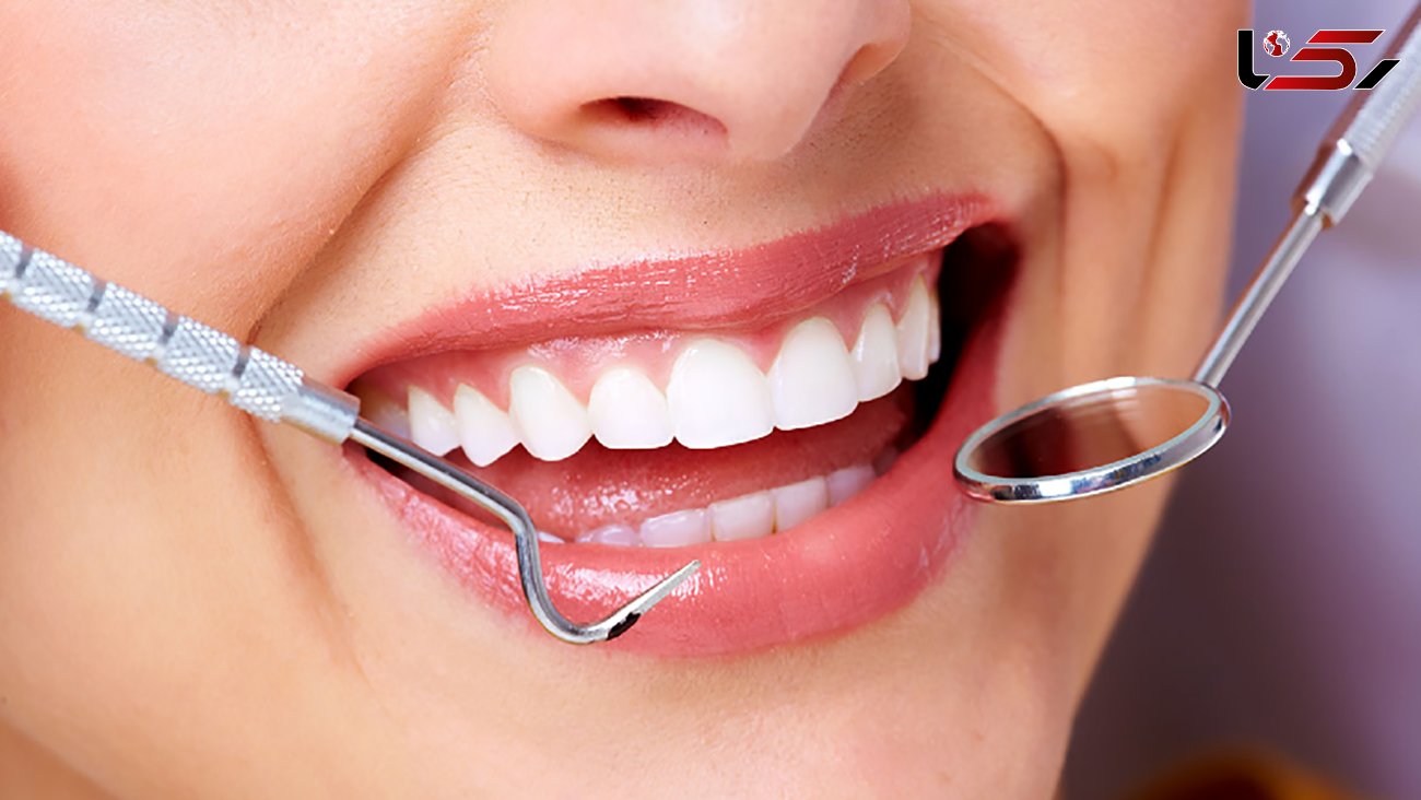 دانستنی های مفید درباره دهان و دندان