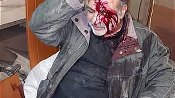 زنده ماندن مرد تهرانی در ریزش سقف مغازه اش + تصاویر