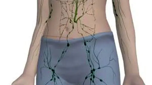 دلیل بزرگ شدن غدد لنفاوی کشاله ران چیست؟