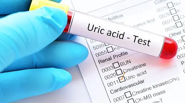  کاهش اسید اوریک با 6 روش 