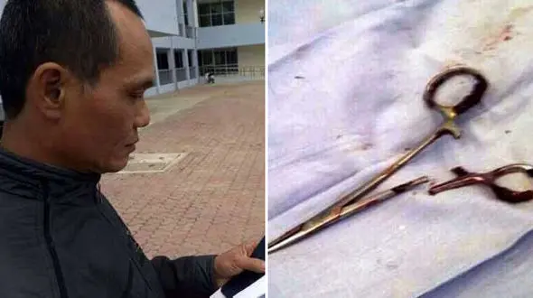   قیچی جراحی 18 سال در شکم  یک مرد بود +عکس 