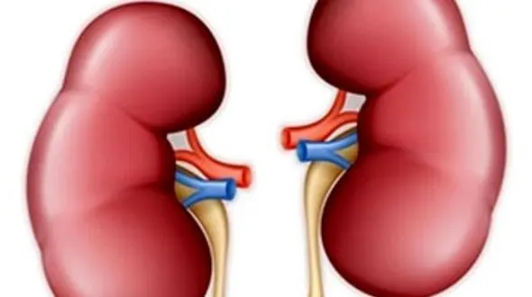 اگر این نشانه ها را دارید به سنگ کلیه مبتلا هستید