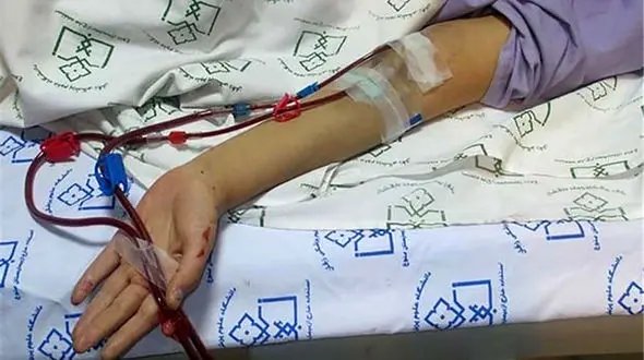 نیش زنبور جوان تهرانی را کشت