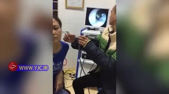 فیلم فجیع از بیرون کشیدن یک جانور از گوش زن ویتنامی
