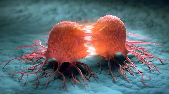 فلوشیپ جراحی سرطان: ترشی و غذاهای دودی نخورید تا سرطان معده نگیرید