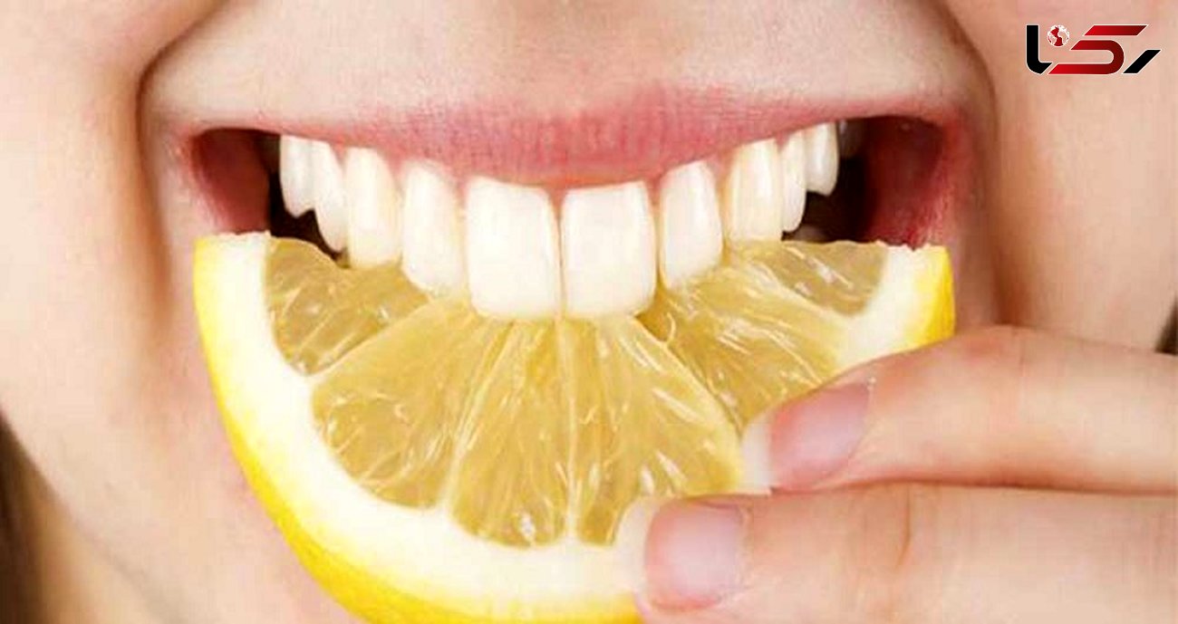 سفیدی دندان ها با پرهیز از مصرف این خوراکی ها