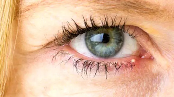 
همه آنچه باید درباره گل‌مژه بدانید