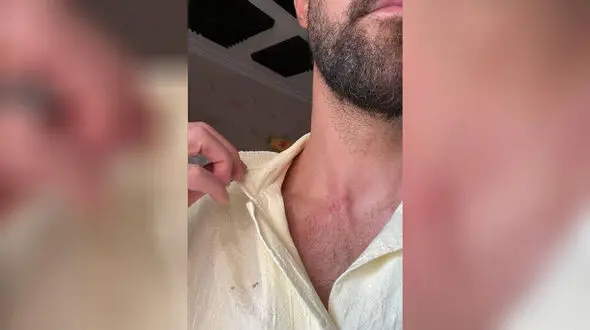 حمله به بازیکن استقلال در اتوبان چمران + واکنش پلیس