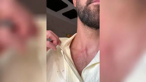 حمله به بازیکن استقلال در اتوبان چمران + واکنش پلیس