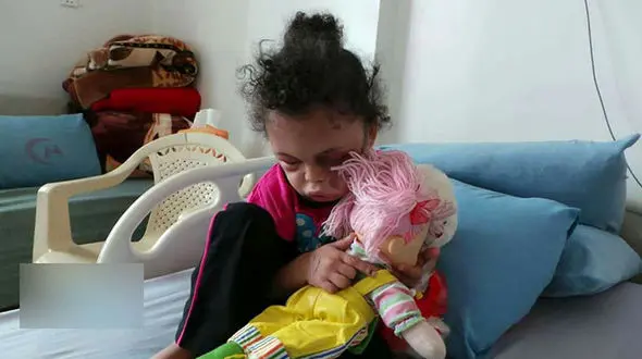 تصاویر کودکی که اعضای خانواده اش قربانی بمباران سعودی ها شدند