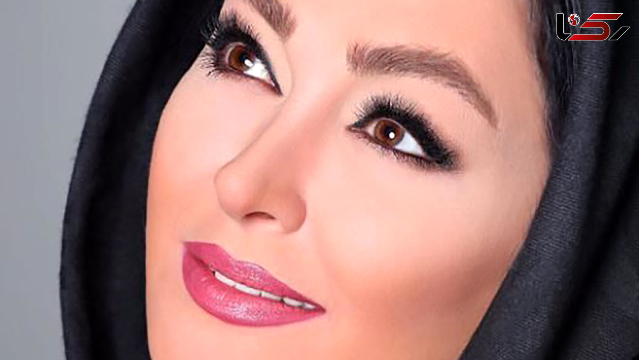 تغییر چهره محسوس الهام حمیدی ! + عکس