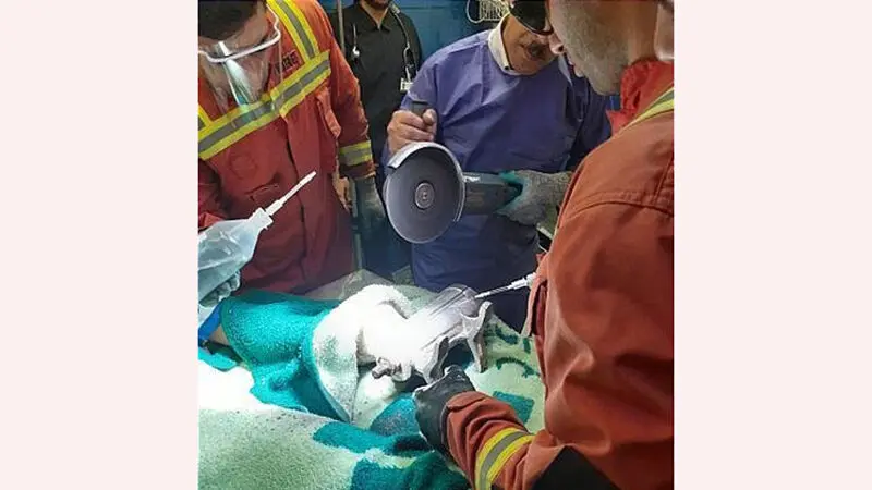  انگشتان دست کارگر ۱۶ ساله رستوران در چرخ‌گوشت صنعتی 