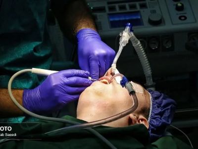 اولین جراحی دندانپزشکی کودکان اتیسم با بیهوشی عمومی؛ تصاویر باورنکردنی