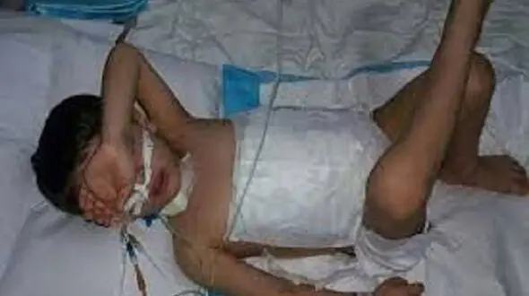 مرگ تلخ کودک 5 ساله خراسانی که توسط یک سگ دریده شده بود + عکس