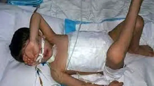 مرگ تلخ کودک 5 ساله خراسانی که توسط یک سگ دریده شده بود + عکس