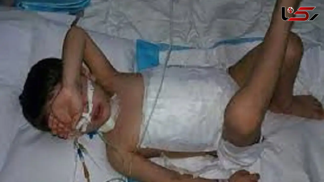 مرگ تلخ کودک 5 ساله خراسانی که توسط یک سگ دریده شده بود + عکس