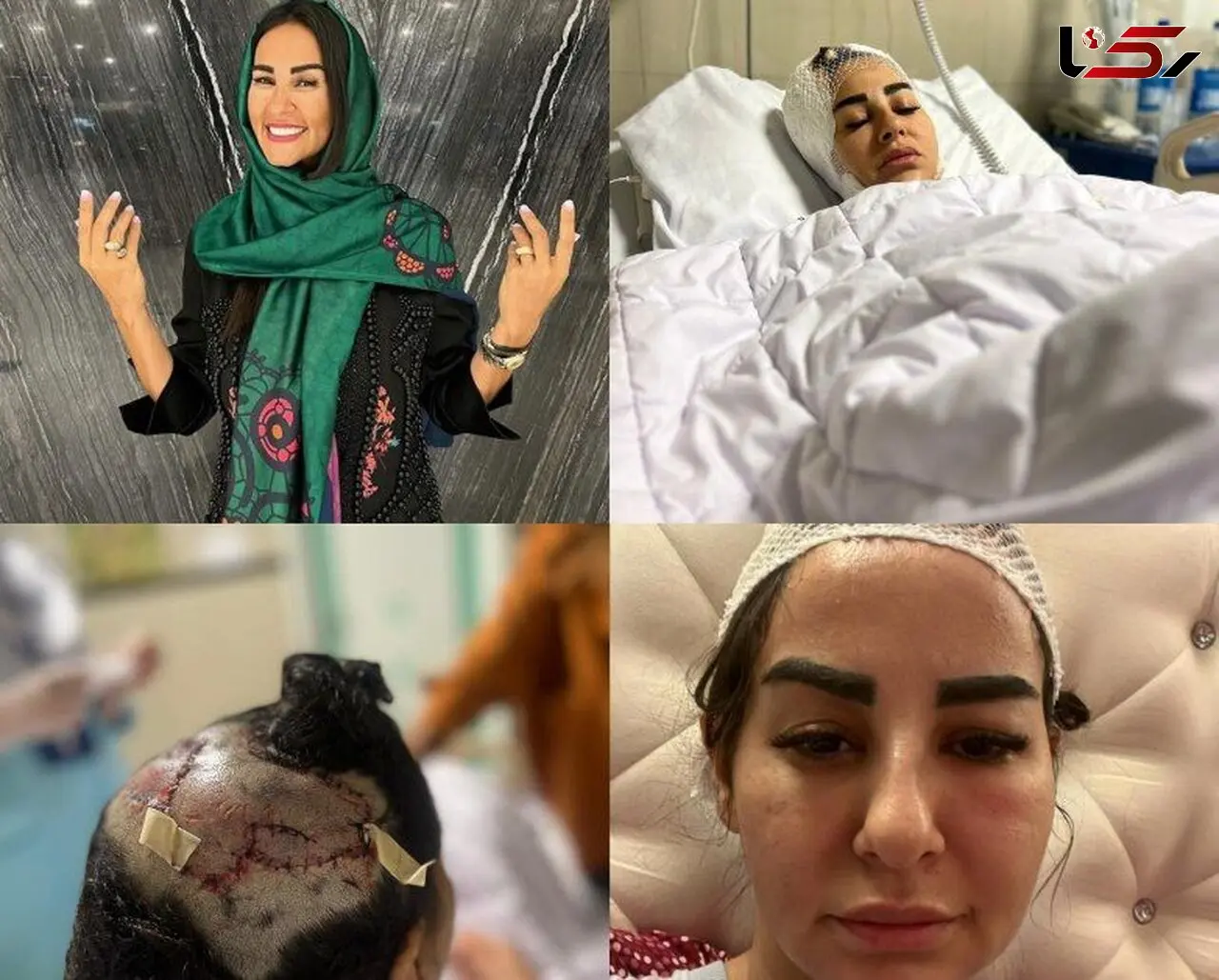 مهسا عابدی قربانی حمله سگ پیت بول در سعادت آباد تهدید به قتل شد + جزییات و فیلم