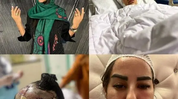 مهسا عابدی قربانی حمله سگ پیت بول در سعادت آباد تهدید به قتل شد + جزییات و فیلم