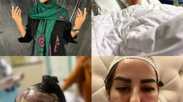 مهسا عابدی قربانی حمله سگ پیت بول در سعادت آباد تهدید به قتل شد + جزییات و فیلم