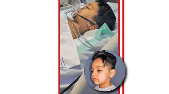 کودک 4 ساله کرجی از مرگ برگشت / معجزه پس از 4 طبقه سقوط+ عکس