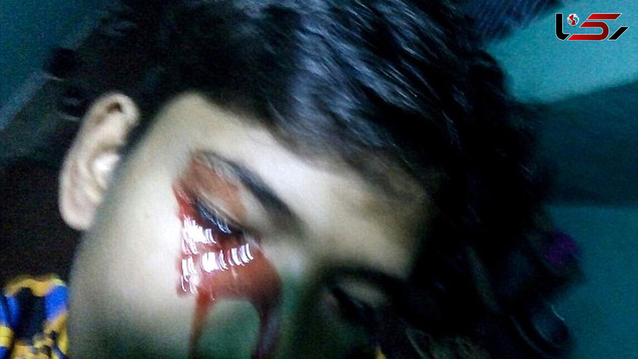 پسر نوجوانی که از موهای سر و صورتش خون می ریزد+گزارش تصویری