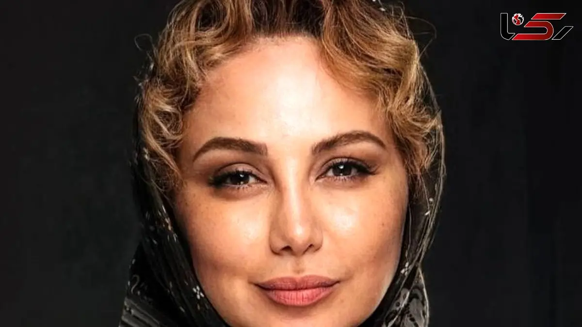 فیلم/ بهنوش بختیاری: قبل از عمل شکل آنجلینا جولی بودم خیلی خوشگل بودم جوگیر شدم با پول کم بدون اجازه پدر و مادرم دماغمو عمل کردم