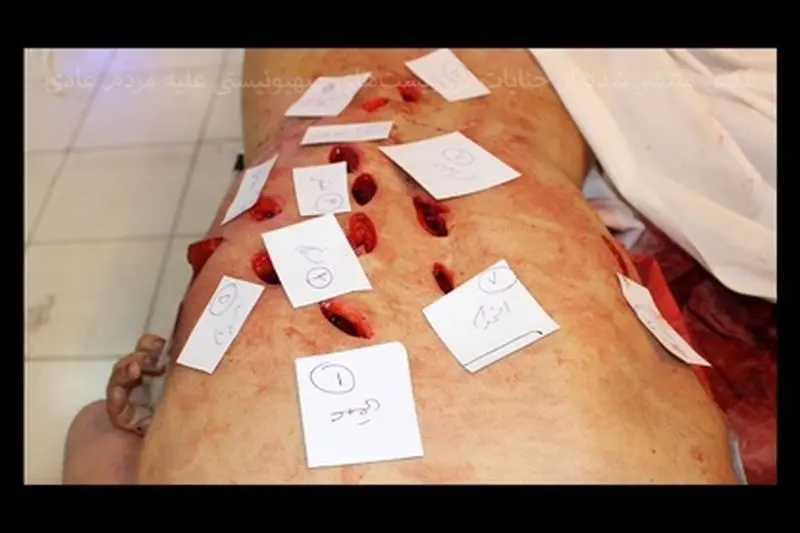 تروریست‌ها هیچ رحمی به مردم عادی نکردند