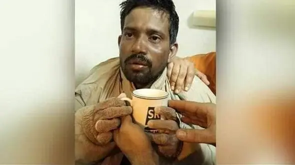 نجات معجزه آسای یک مرد پس از ۵ روز سرگردانی در دریا +عکس
