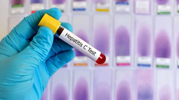 تست کرونا رایگان است