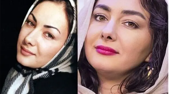 چرا هانیه توسلی بازیگر زخم کاری ازدواج نمی کند؟ | بیوگرافی هانیه توسلی