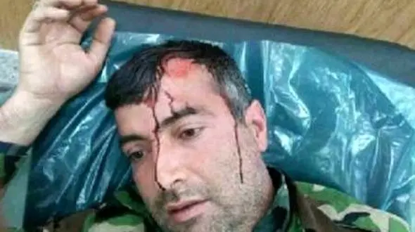 فوری / حمله با تبر به قرق بان گلستانی در جنگل+ عکس