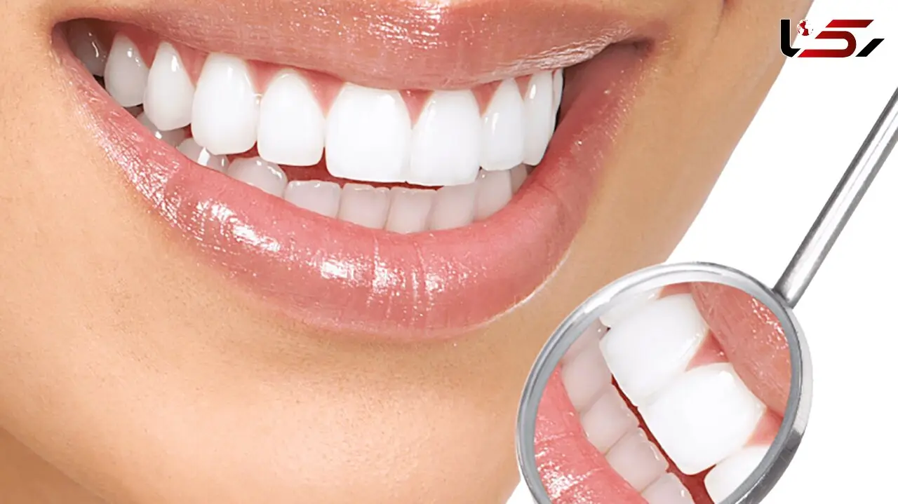 دلایل تغییر رنگ دندان چیست؟