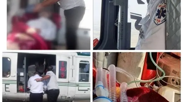 انتقال هوایی زن سوخته از املش به رشت + عکس