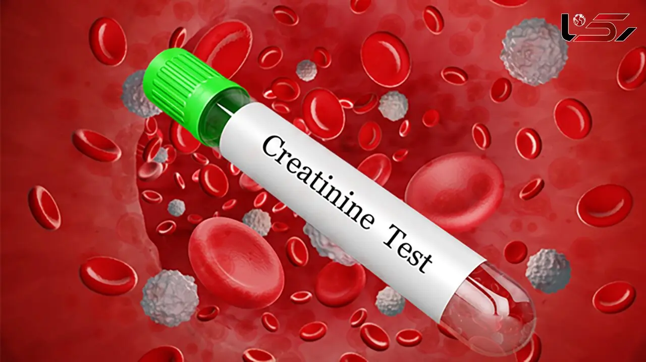 creatinine کراتینین چیست؟ + جدول