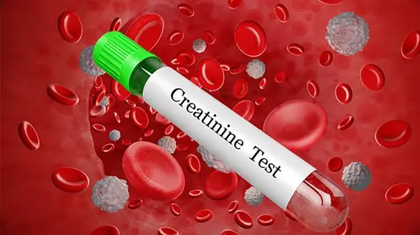 creatinine کراتینین چیست؟ + جدول